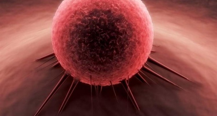 هجوم خاموش سونامی سرطان در ایران