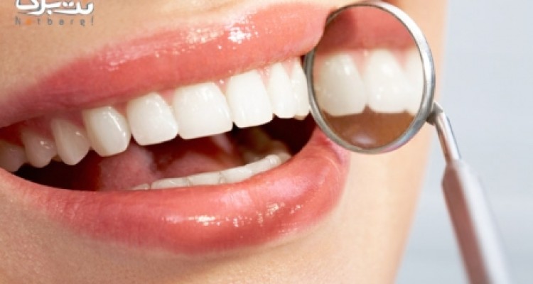 ارتقاسن مشمولین خدمات دندانپزشکی/ خدمات بیمه‌ها یکسان سازی می شود