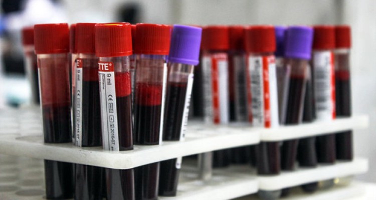 اهدای خون در کرمانشاه طی شب های قدر ۲۱ درصد افزایش یافت