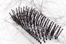  چرا موهای مردها می‌ریزد؟ 