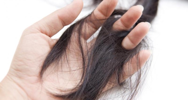  جوش این مدلی و ریزش مو به هم ربط دارند 