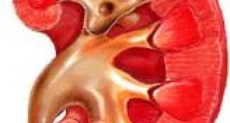 بعضی عادات مخرب به کلیه ها صدمه می زند