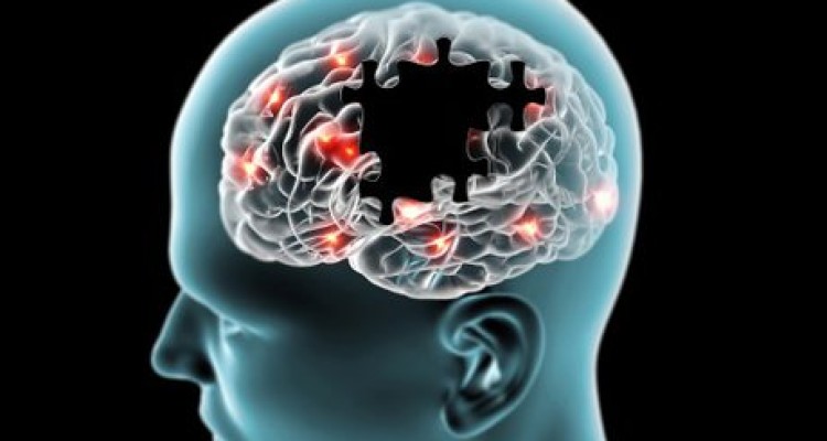  آلزایمر قابل پیشگیری است