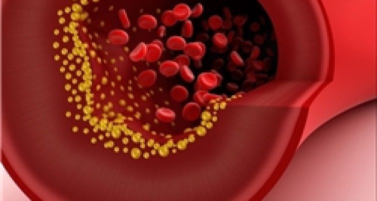 4 راهکار اساسی برای کاهش کلسترول