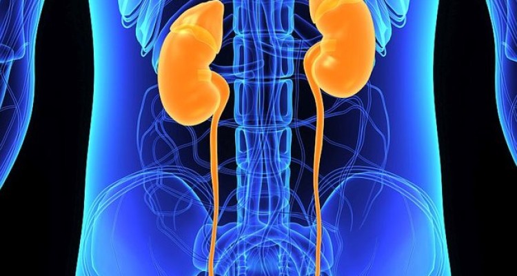  برای دفع سنگ کلیه چه کنیم؟