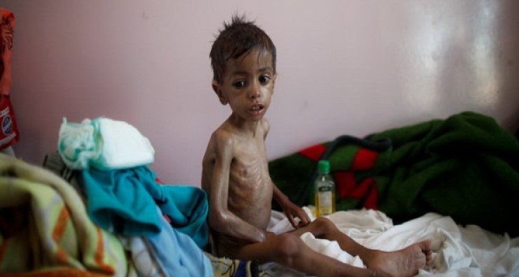 هشدار مجدد سازمان ملل درباره وقوع قحطی در یمن