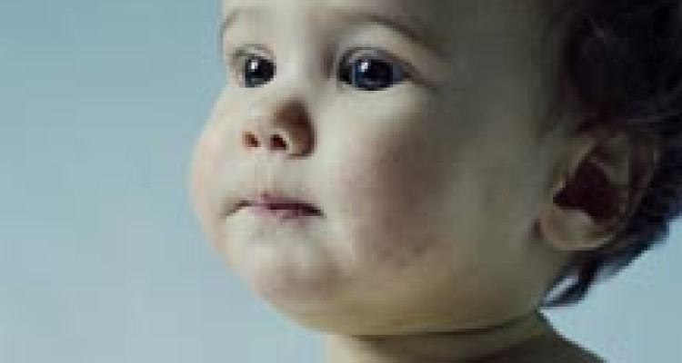  اگزمای کودکان 