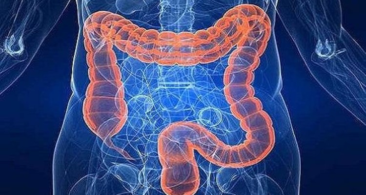 خوراکی های تاثیرگذار بر سلامت روده ها