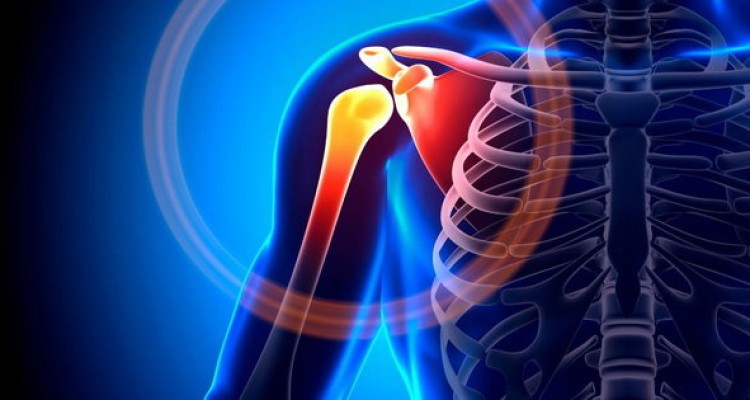  ۷ دلیل شایع درد شانه