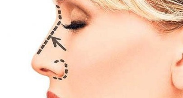دستگاه‌های کوچک‌کننده بینی تاثیری بر زیبایی بینی ندارند 