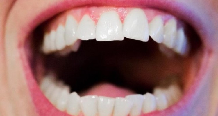  ۳ توصیه برای پیشگیری از بوی بد دهان