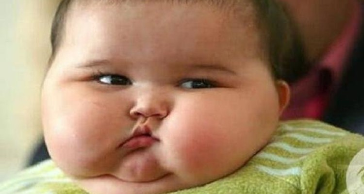 چاقی کودک عامل افزایش ریسک آرتروز لگن و زانو