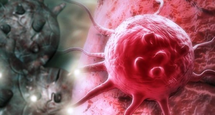 اسیدهای چرب اُمگا۳ موجب توقف پیشرفت سرطان می شود