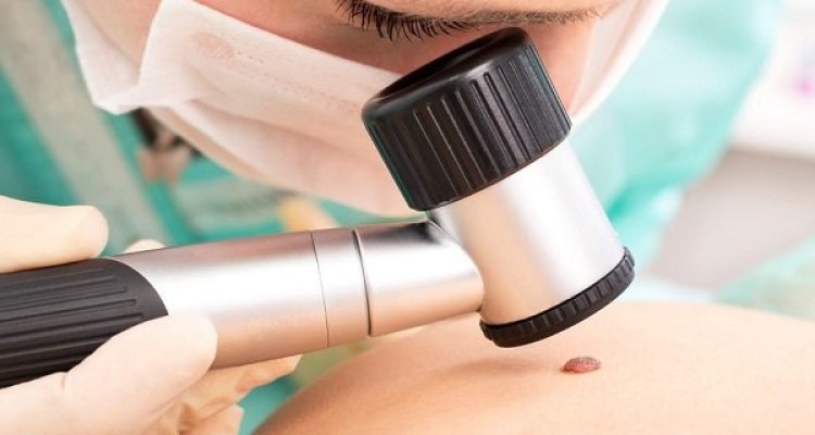 بیماران سرطانی در معرض ابتلا به مشکلات پوستی