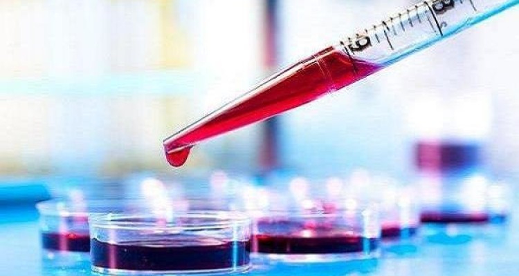 تشخیص صحیح بیماری آلزایمر با آزمایش خون