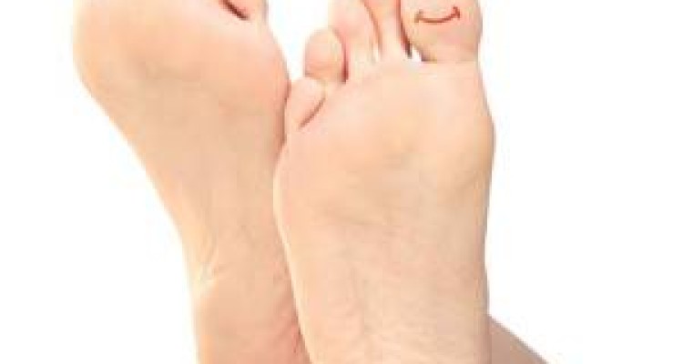  چگونه از انحراف انگشت شست پا جلوگیری کنیم؟