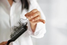 دلایل رایج ریزش مو در زنان
