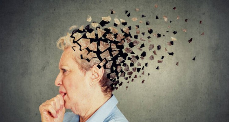  برای پیشگیری از آلزایمر چه کنیم؟