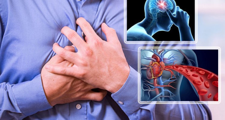 ۶۲ هزار مرگ سکته ای در سنین زیر ۷۰ سال کشور