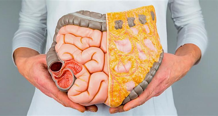 این ده خوراکی یبوست را حادتر می‌کنند