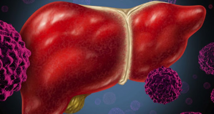  مراقب علائم هپاتیت باشید