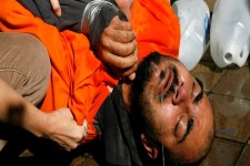 انجام آزمایشات پزشکی روی زندانیان با مجوزسازمان اطلاعات مرکزی آمریکا