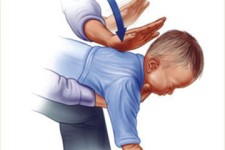  علل و روش های پیشگیری از خفگی 