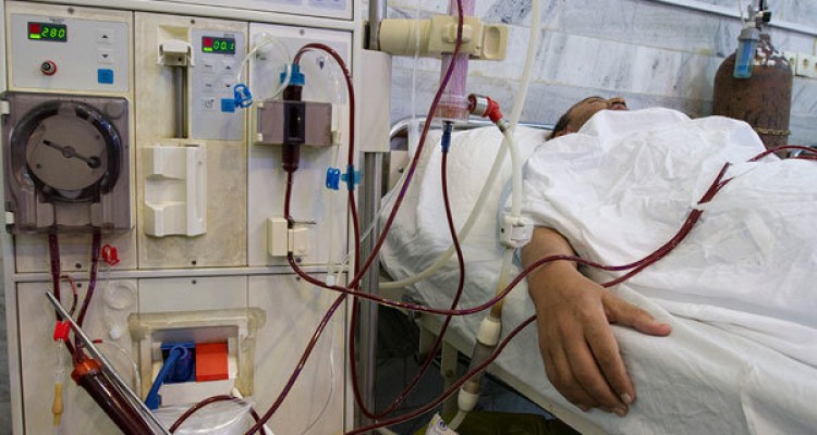 نارسایی کلیه احتمال سرطان را افزایش می دهد