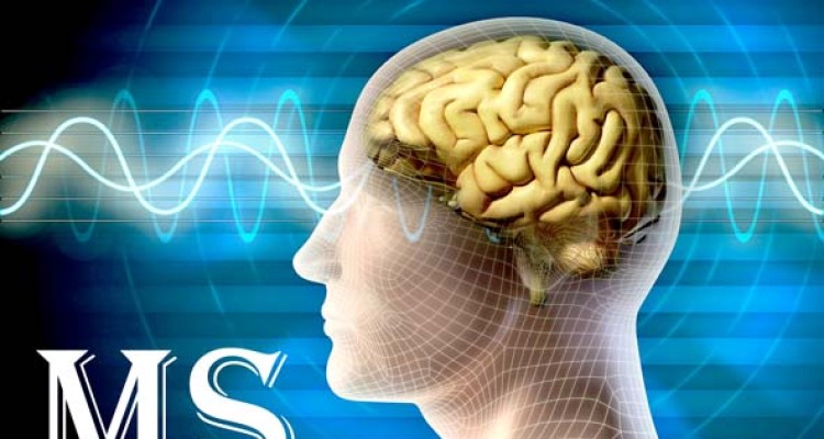 بیماری ام اس درمان شد