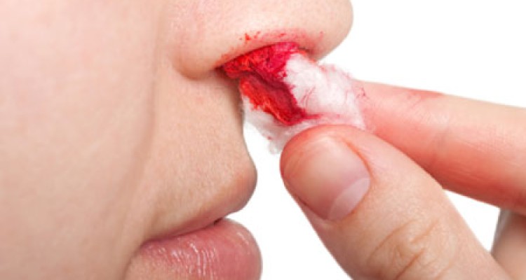  علل خون‌ دماغ شدن و درمان آن 