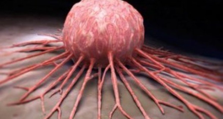 علت شیوع بیشتر سرطان در مردان مشخص شد