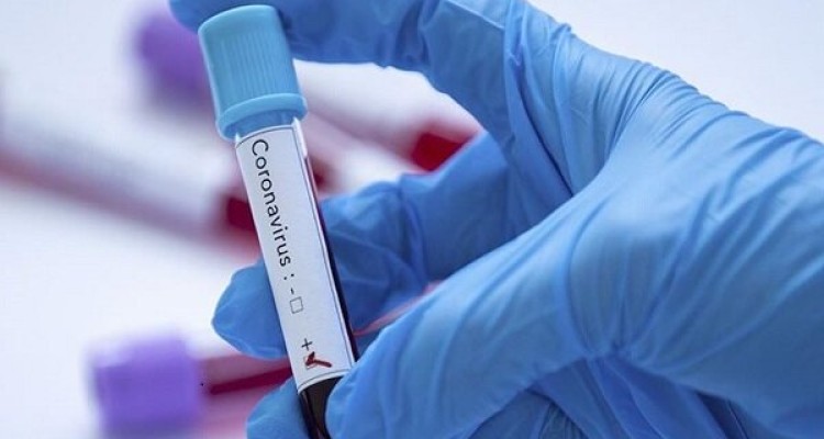 ایجاد فاصله بین افراد در کنترل بیماری کرونا موثر است