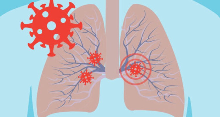  موارد حاد کووید-۱۹ چگونه به قلب آسیب می‌زند؟