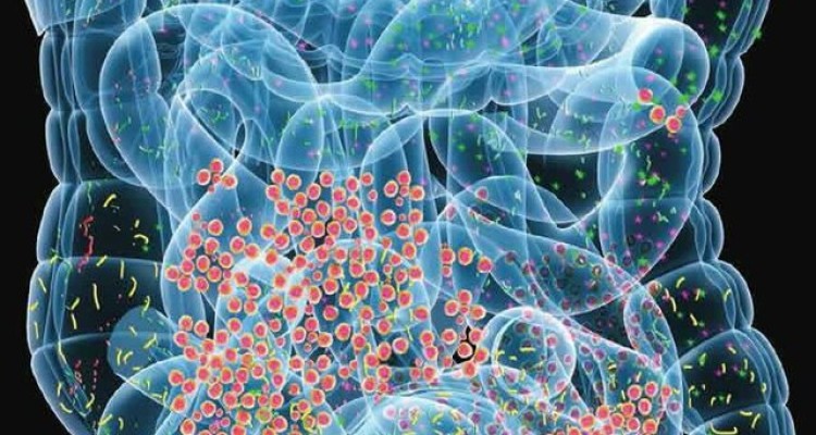  شایع‌ترین بیماری‌های گوارشی در ایرانیان