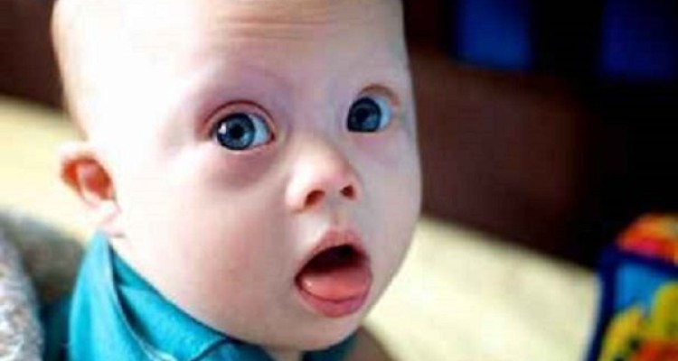 شدت بیماری کووید ۱۹ در معلولان ذهنی بیشتر است