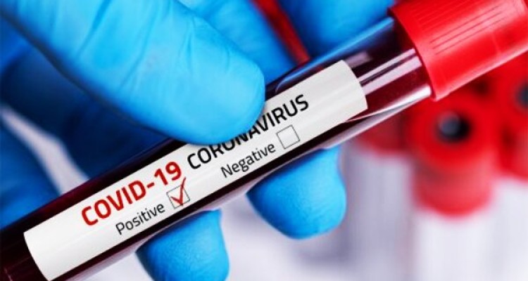 کرونا درمان قطعی ندارد/ این بیماری کشنده است