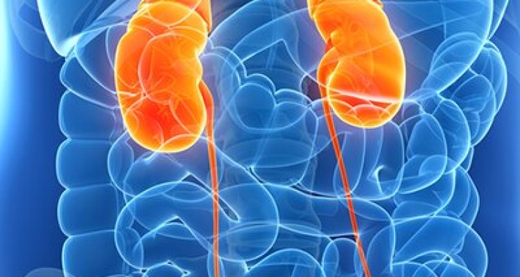  راه‌های درمان سنگ کلیه و پیشگیری از عود مجدد
