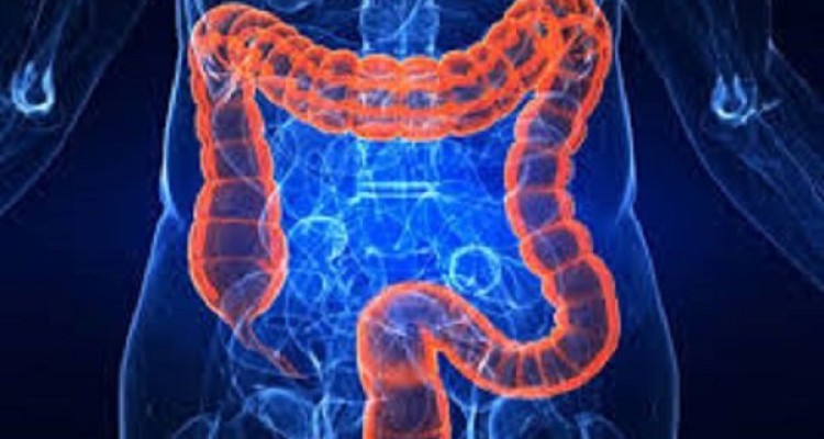 سو جذب روده باعث چه بیماری‌هایی می‌شود؟