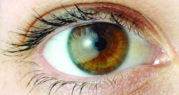 ویتامین A به درمان نابینایی ناشی از دیابت کمک می کند