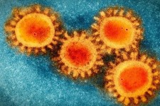 احتمال انتقال ویروس کووید ۱۹ از طریق شیرمادر وجود ندارد