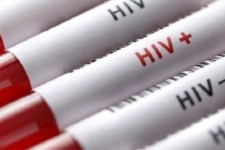 موفقیت ۹۷ درصدی درمان ایدز در کرمانشاه