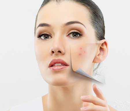  جوش صورت مان را در آرایش چگونه محو کنیم؟ 