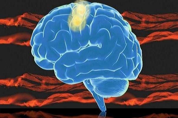 فقدان گلوکر در مغز ریسک آلزایمر را پیش بینی می کند