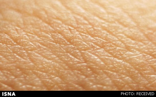  "لک و پیس" چگونه پوست را درگیر می‌کند؟