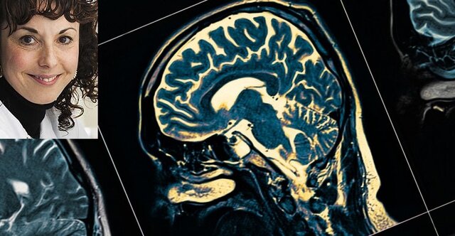  تشخیص چند دهه زودتر بیماری آلزایمر با یافته جدید دانشمند ایرانی