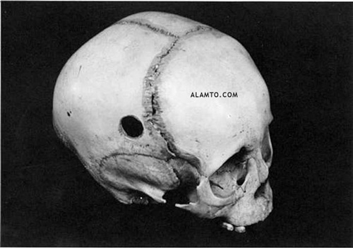 عجیب ترین جمجمه های جهان + عکس